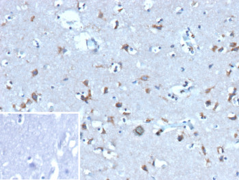 Anti-Ubiquitin, clone rFPM1