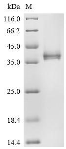 Interleukin-12 receptor subunit beta-2 (IL12RB2), partial, human, recombinant