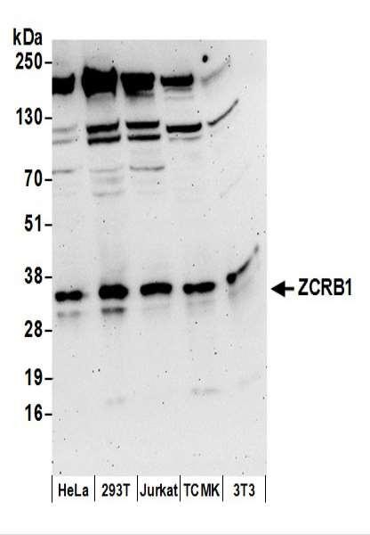 Anti-ZCRB1