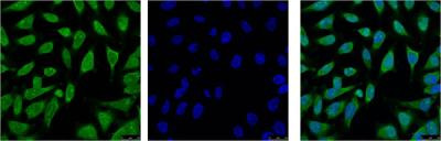 Anti-HSPA1A