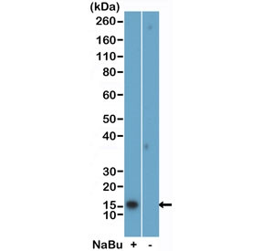 Anti-H2BK5ac / Acetyl-Histone H2B Lysine 5, clone RM455