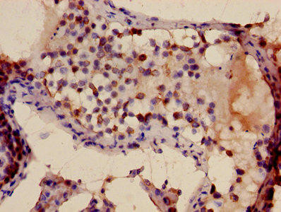 Anti-TFDP3