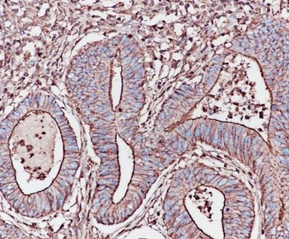 Anti-Actin, clone SQab18109