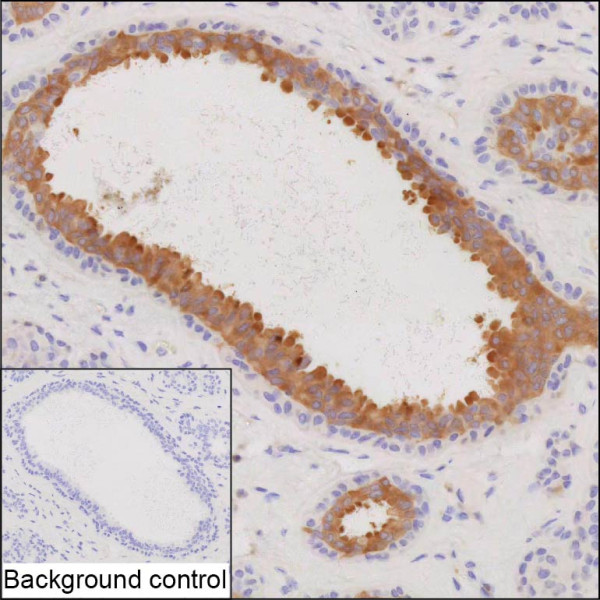Anti-INPP4B
