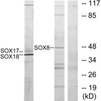 Anti-SOX8/SOX9/SOX17/SOX18