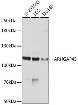 Anti-ARHGAP45