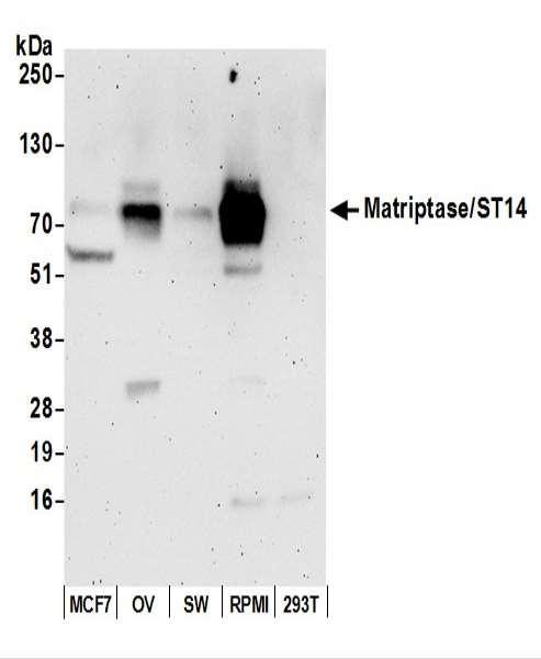 Anti-Matriptase/ST14