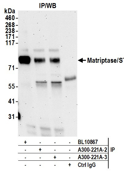 Anti-Matriptase/ST14