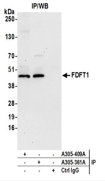 Anti-FDFT1