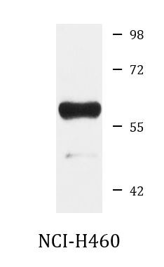 Anti-MICB
