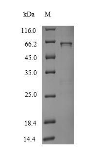 UDP-glucuronosyltransferase 1A1 (UGT1A1), human, recombinant