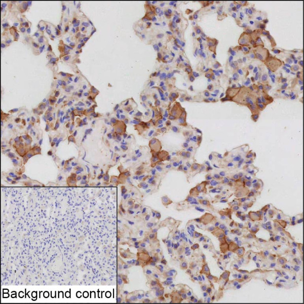 Anti-CSF1 Recombinant