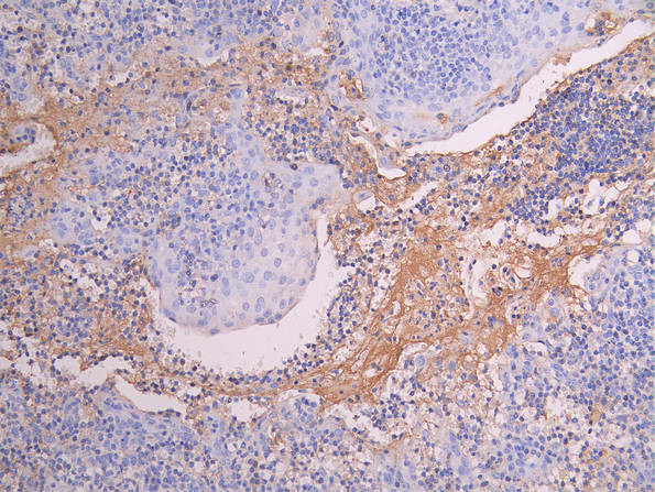 Anti-MMP9, recombinant clone 9B2