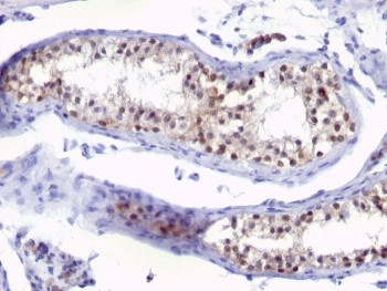 Anti-Thymidylate Synthase, clone SPM453