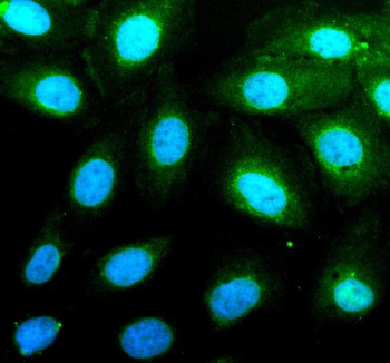 Anti-PAG1 / Cbp / Phosphoprotein associated with glycosphingolipid-enriched microdomains 1