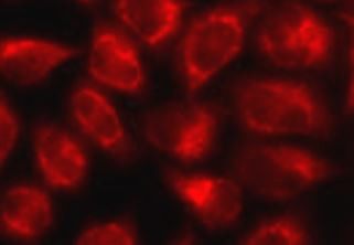 Anti-DNM1L / DRP1