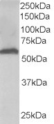 Anti-58K Golgi protein(N-Term)/FTCD, N-terminal