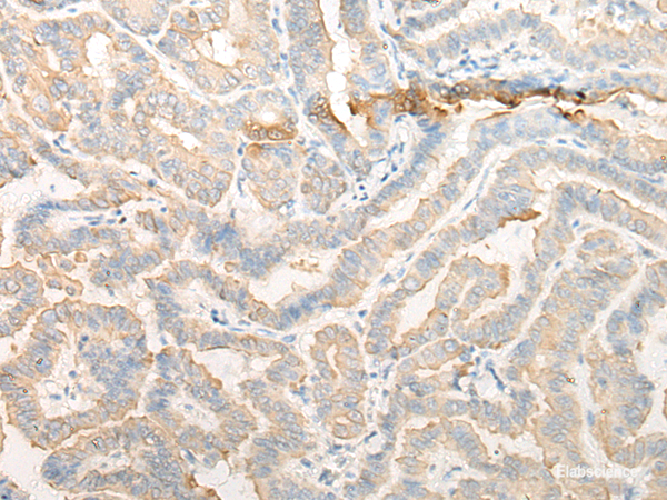 Anti-CELA3A