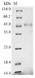 Calreticulin (Calr), mouse, recombinant