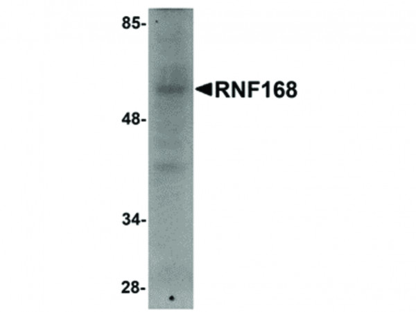 Anti-RNF168