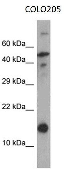 Anti-Cystatin SN