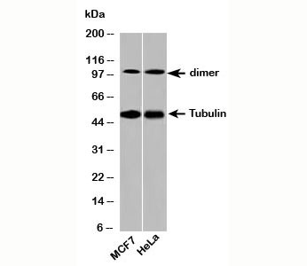 Anti-Beta Tubulin Loading Control