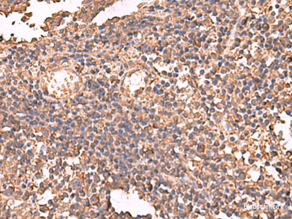 Anti-LDHAL6B