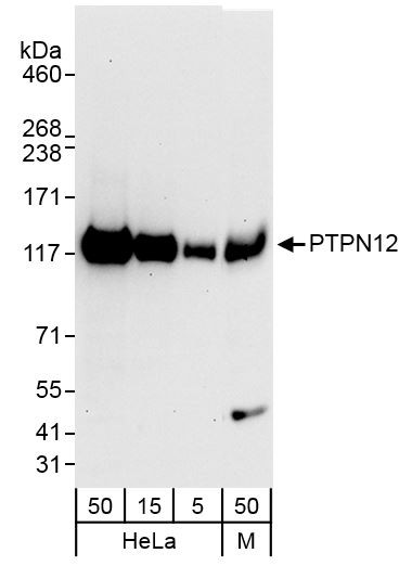 Anti-PTPN12