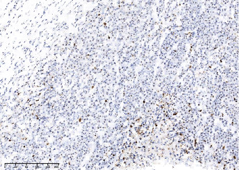 Anti-PARP-1 Monoclonal Antibody