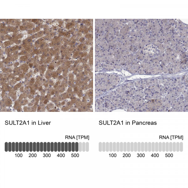 Anti-SULT2A1