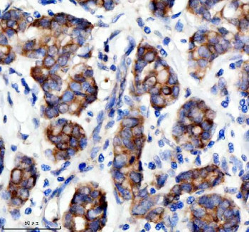 Anti-SESN2 / Sestrin 2