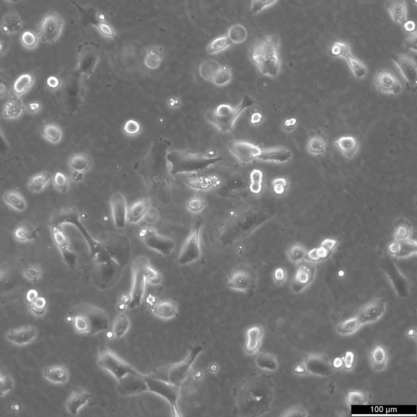 HCC70 Cells