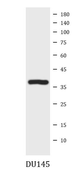 Anti-GPR65 / TDAG8