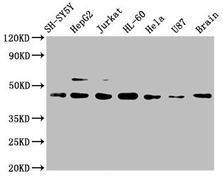 Anti-CCR9 Recombinant Monoclonal, clone 4G2