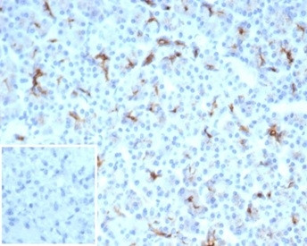 Anti-CFTR (Cystic Fibrosis Transmembrane Conductance Regulator), recombinant antibody, clone CFTR/70