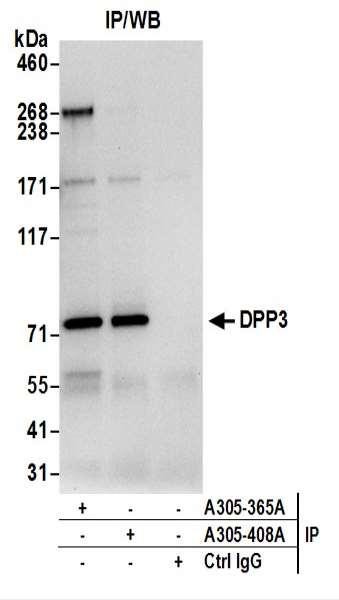 Anti-DPP3