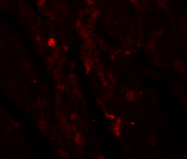 Anti-IDH2