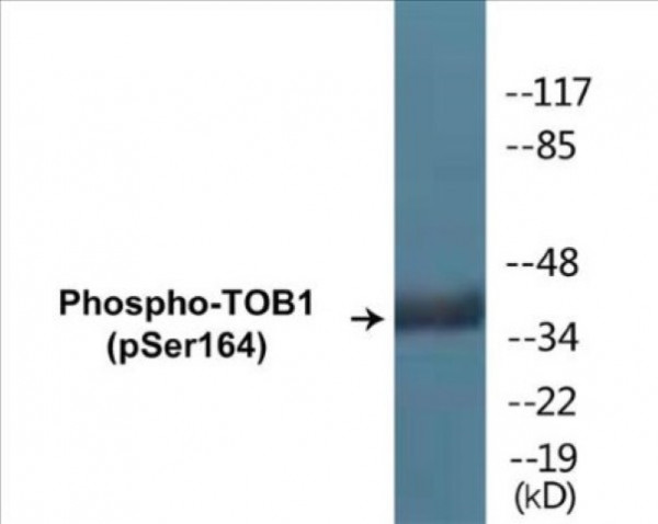 TOB1 (Phospho-Ser164) Colorimetric Cell-Based ELISA Kit