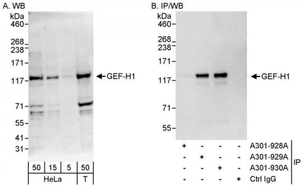 Anti-GEF-H1