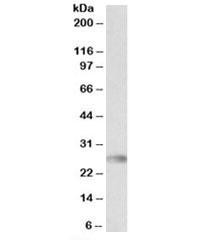 Anti-HLA-DQA2