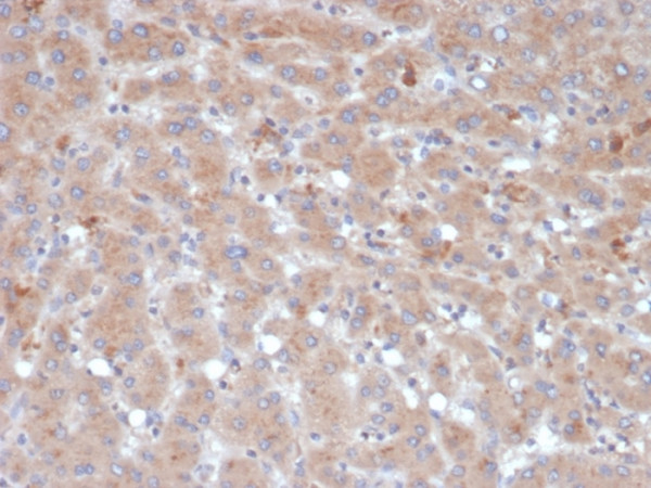 Anti-Alpha-1-Antichymotrypsin (SERPINA3) (Histiocytoma Marker), clone SERPINA3/4189