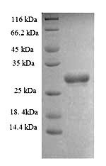 SWI/SNF complex subunit SMARCC1 (SMARCC1), partial, human, recombinant