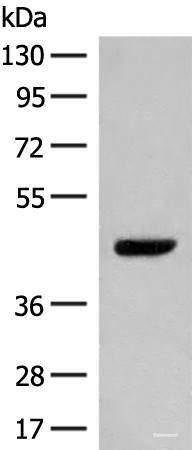 Anti-GPR52