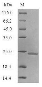 Aquaporin Z (aqpZ) (Active), Escherichia coli, recombinant