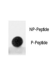 Anti-MDM2 (pS395)