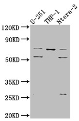 Anti-PTH1R Recombinant Monoclonal, clone 1G7