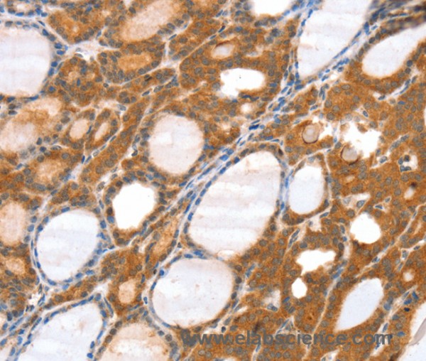 Anti-SRGAP3
