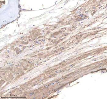 Anti-Zebrafish Pi4kb / Phosphatidylinositol 4-kinase beta