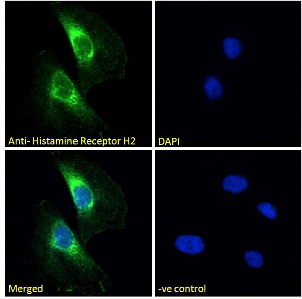 Anti-Histamine Receptor H2, C-terminal