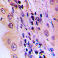 Anti-LIPC
